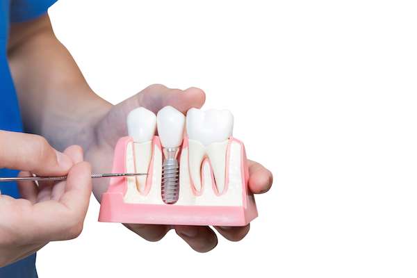 Can You Get Dental Implants if You Have Gum Disease from Town Square Dentistry in Boynton Beach, FL