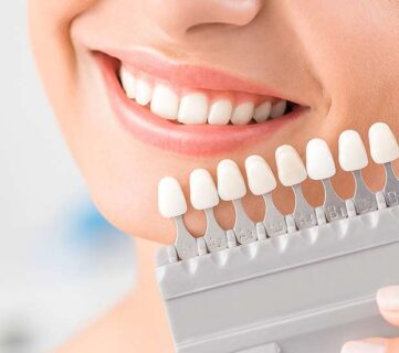 dental veneers vs dental laminates