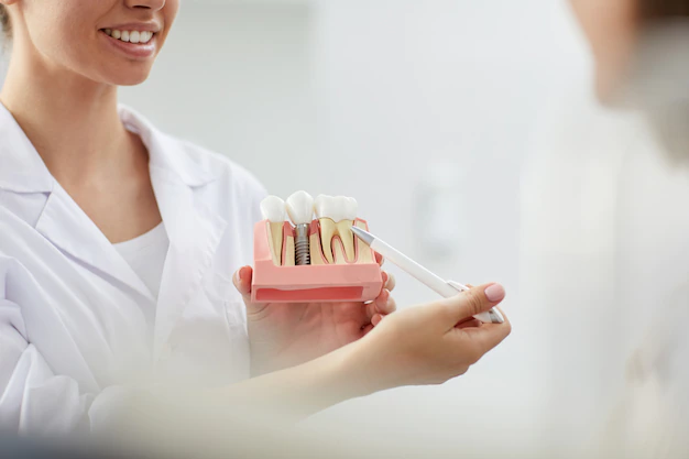 Recovery &#   ; After Care Tips For Dental Implants