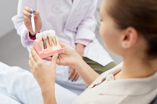 Questions To Ask When Selecting An Implant Dentist